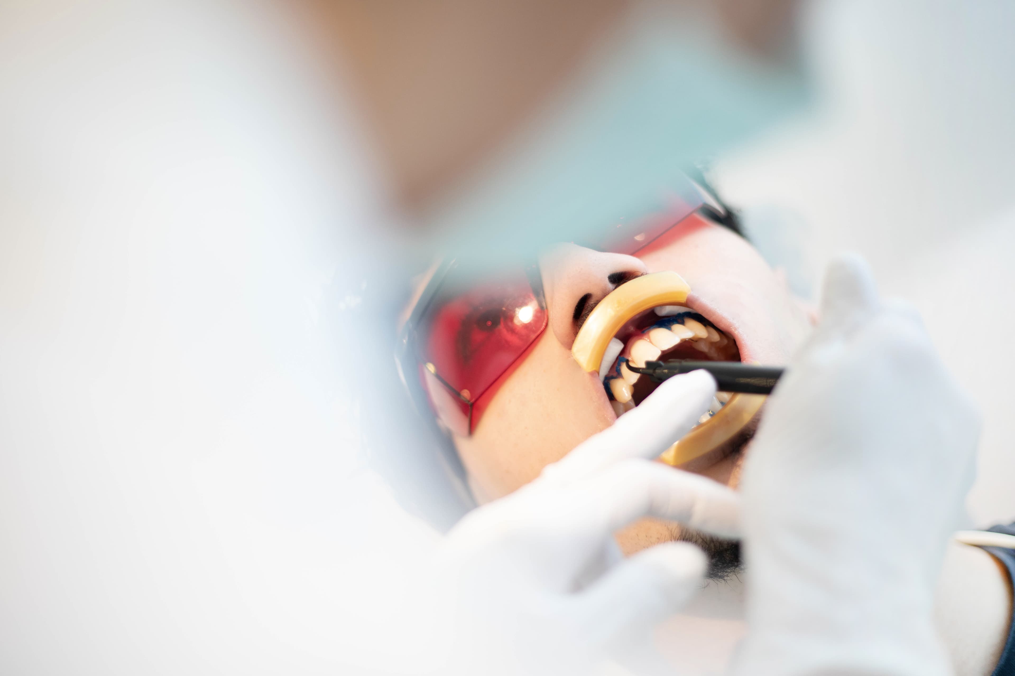 whiteberry smile Team